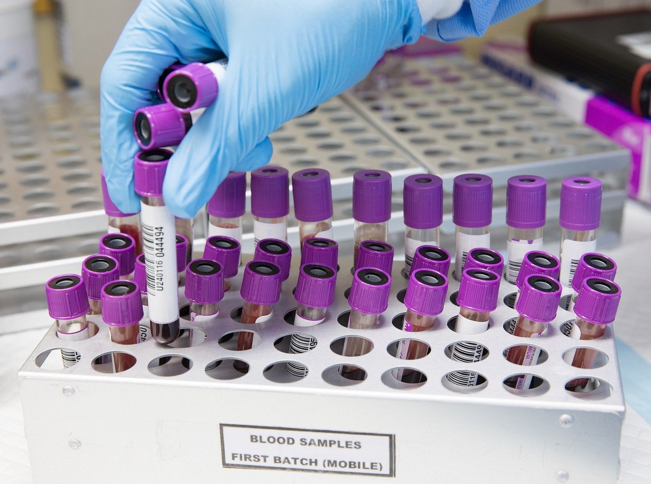 laboratory samples from the Ohio case showed genotype D1.3 of H5N1